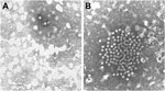 Thumbnail of Electron microscopy images of astrovirus-like particles in fecal samples from 2 patients in Italy: A) strain ITA/2007/PR326, from a 4-year-old child hospitalized in January 2007; and B) strain ITA/2008/PR3147, from a 14-month-old child hospitalized in November 2008. The viral particles are ≈28–30 nm in diameter. Scale bars represent 100 nm.