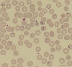 Thumbnail of Photomicrography of a Giemsa-stained thin film of a 46-year-old man showing Babesia divergens. Double pear-shaped intraerythrocytic parasites are indicated by arrows. Slides were examined with a Nikon microscope at 60× magnification. Scale bar indicates 500 nm.