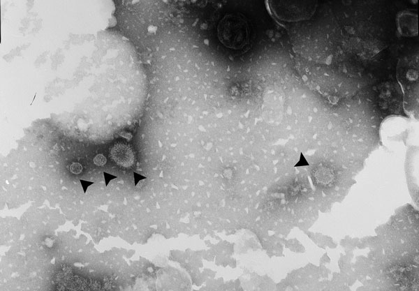 Negative-staining electron micrograph image showing influenza A(H1N1)pdm09 virus particles (arrowheads) in allantoic fluid supernatant collected from specific pathogen free eggs after injection with a nasal swab sample collected from a giant panda in China. Original magnification ×40,000.