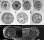 Thumbnail of A–D) Views showing the technique used for hook counts of Gnathostoma spp., United States, En face (panels A, B) and posterior (panels C,D) views showing the technique used for hook counts; specimen shown here is of Gnathostoma spinigerum from eel 59 specimen b from gastrointestinal digestion. E–G) En face mounts of the cephalic bulbs of specimens identified as 3 different species on the basis of molecular data: panel E, specimen eel 59 G, a, G. spinigerum; panel F, specimen eel 48 M