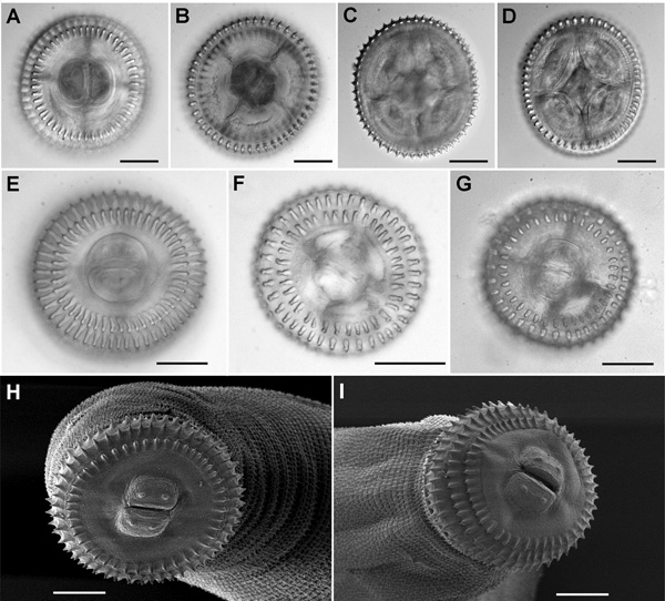 A–D) Views showing the technique used for hook counts of Gnathostoma spp., United States, En face (panels A, B) and posterior (panels C,D) views showing the technique used for hook counts; specimen shown here is of Gnathostoma spinigerum from eel 59 specimen b from gastrointestinal digestion. E–G) En face mounts of the cephalic bulbs of specimens identified as 3 different species on the basis of molecular data: panel E, specimen eel 59 G, a, G. spinigerum; panel F, specimen eel 48 M, c, G. turgi