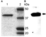 Thumbnail of Polyacrylamide gel electrophoresis purification (A) and Western blot analysis (B) of recombinant glycerophosphodiester phosphodiesterase (rGlpQ). A) Coomassie blue staining of purified Borrelia miyamotoi sensu lato rGlpQ (lane 1) and of Precision Plus Protein Prestained Standards (Bio-Rad, Laboratories, Hercules, CA, USA) (lane 2). B) Western blot analysis of B. miyamotoi sensu lato–positive control mouse serum shows 39-kDa rGlpQ-specific band (arrow).