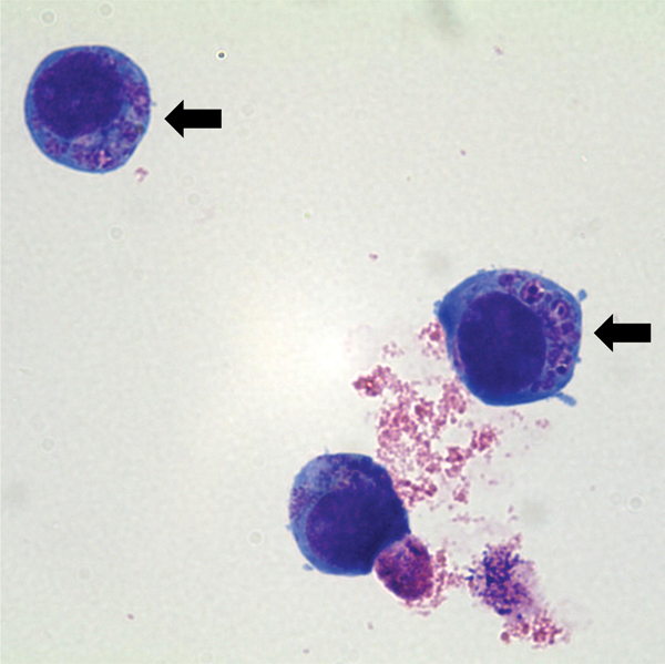 Light micrograph of Anaplasma phagocytophilum cultured in human promyelocytic cell line HL-60, showing A. phagocytophilum morulae as basophilic and intracytoplasmic inclusions (arrows). Wright–Giemsa stain, original magnification x1,000. 
