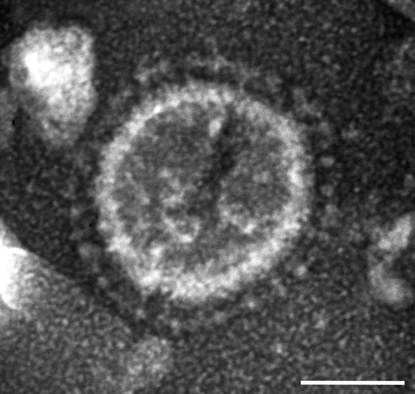 Electron micrograph of a US porcine epidemic diarrhea virus (PEDV) particle detected in a field fecal sample collected during a 2013 outbreak of PED on a farm in Ohio, USA; the fecal sample from which PEDV strain PC21A in this study was detected was from a pig on the same farm during the same outbreak. The sample was negatively stained with 3% phosphotungstic acid. Scale bar = 50 nm.