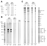 Thumbnail of Immunoblot analysis of serum reactivity to antigens of Borrelia miyamotoi and Lyme disease borreliae, Japan. Serum samples obtained from 2 patients were examined. For case-patient 1, acute-phase serum obtained on July 25, 2011, and convalescent-phase serum obtained on August 10 were used. For case-patient 2, acute-phase serum obtained on June 11 was used. A) Reactivity to recombinant glycerophosphodiester phosphodiesterase (GlpQ) antigen. Crude rGlpQ were used for immunoblot analysi