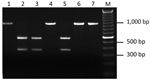 Thumbnail of Restriction fragment length polymorphism patterns of the 16S ribosomal DNA for 7 A. phagocytophilum PCR-positive I. scapularis. All amplicons were produced by semi-nested PCR and digested with the restriction enzyme Kpn2I. Lane M, molecular mass marks.