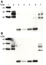 Thumbnail of Western blot analysis of PrPres in extracts of frontal cortex tissue prepared from postmortem samples from 2 persons with sCJD (subtypes MM1 and VV2) and the 3 persons with VPSPr whose brain samples were used for experimental transmission studies in transgenic mice (patients NL-VV, UK-VV, and UK-MV). Extracts from another patient who had VPSPr of UK origin (codon 129VV genotype) was also included on the blot (lane 6). Duplicate blots were probed with the following monoclonal antibod