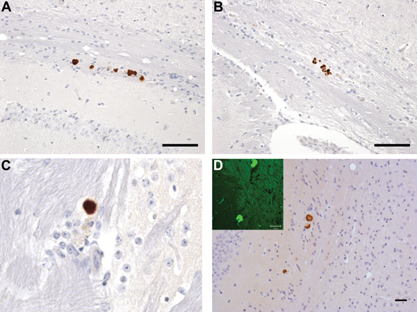 Neuropathology in transgenic mice following inoculation with brain homogenate prepared from a postmortem sample from a person with VPSPr. Numerous PrP-labeled plaque-like deposits within the corpus callosum of HuVV (A) and HuMV (B) mice inoculated with brain homogenate from patient UK-VV. C) A single small PrP-labeled plaque in the stratum oriens of the hippocampus following experimental challenge with brain homogenate from patient NL-VV. D) PrP-labeled plaque-like-deposits in the corpus callosu