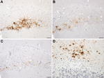 Thumbnail of Neuropathology in transgenic mice following inoculation with brain homogenate prepared from a postmortem sample from a person with VPSPr. A–C) Immunohistochemistry for the PrP, showing small granular and microplaque-like deposits within the CA3 region of the hippocampus of a HuVV mouse challenged with VPSPr inoculum prepared from patient UK-VV. Differential staining was observed in this mouse by using the following PrP antibodies: Purified (3F4) (Cambridge Bioscience, Cambridge, UK)