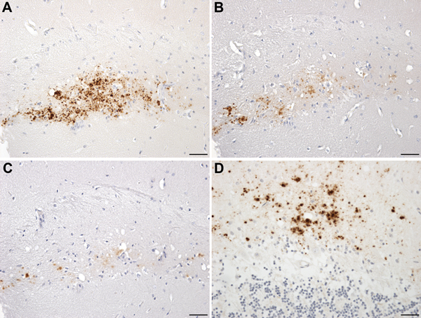 Neuropathology in transgenic mice following inoculation with brain homogenate prepared from a postmortem sample from a person with VPSPr. A–C) Immunohistochemistry for the PrP, showing small granular and microplaque-like deposits within the CA3 region of the hippocampus of a HuVV mouse challenged with VPSPr inoculum prepared from patient UK-VV. Differential staining was observed in this mouse by using the following PrP antibodies: Purified (3F4) (Cambridge Bioscience, Cambridge, UK) (A); Prion P