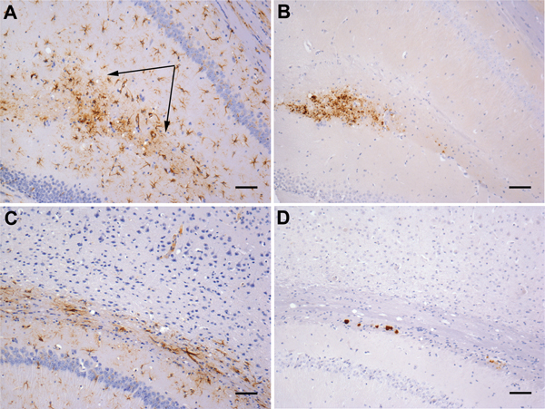 Gliosis in transgenic mice following inoculation with brain homogenate prepared from a postmortem sample from a person with variably protease-sensitive prionopathy. A) Immunohistochemical staining for GFAP in the hippocampus of a HuVV mouse showing microplaque-like deposits. Arrows indicate areas of reactive astrocytosis. B) A serial section from the same HuVV mouse immunolabeled for PrP by using monoclonal antibody (Purified [3F4], Cambridge Bioscience, Cambridge, UK). C) Immunohistochemical st