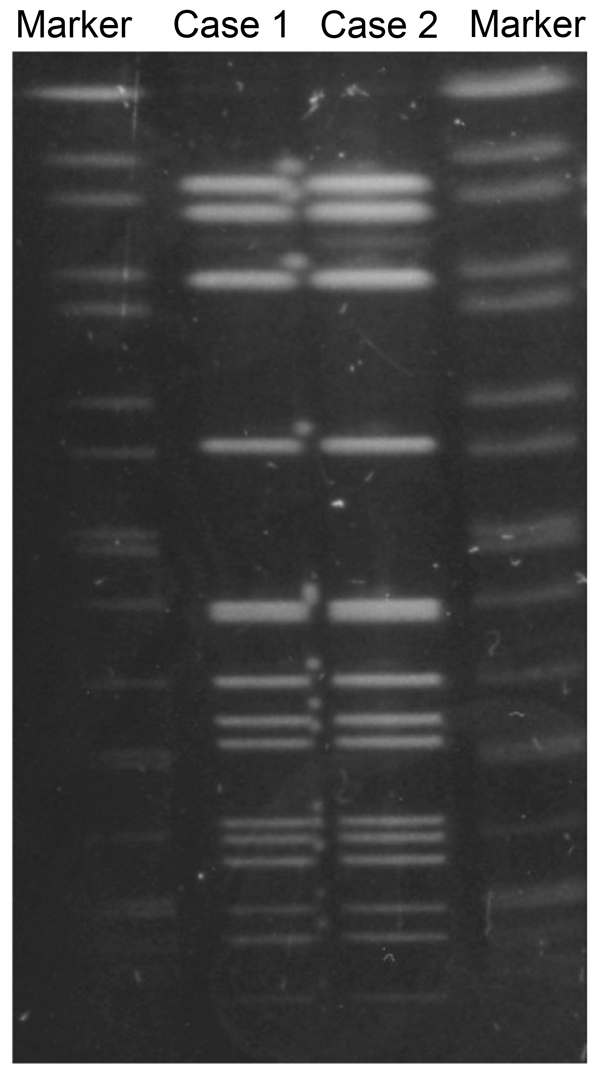 Pulsed-field gel electrophoresis (PFGE) patterns for N. meningitidis strains isolated from a man with urethritis (case 1) and his male sex partner (case 2), Japan. PFGE was performed with the restriction enzyme NheI. Results showed the same PFGE pattern for both isolates. Salmonella enterica serovar Braenderup strain H9812 was used as the PFGE size marker strain; it was digested with Xbal and resolved by PFGE.