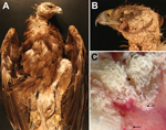 Thumbnail of Golden eagle found grounded in King City, California, USA, during August 2013 (eagle 3). A) Photograph of diffuse crusting and thickening of the head, neck, and legs. B) Photograph showing severe obliteration of the skin over the eyelid and ear. C) Dissecting microscope cross-section of the affected skin, showing thick trabeculae of keratin deposition (*) and white to transparent mites (arrows).