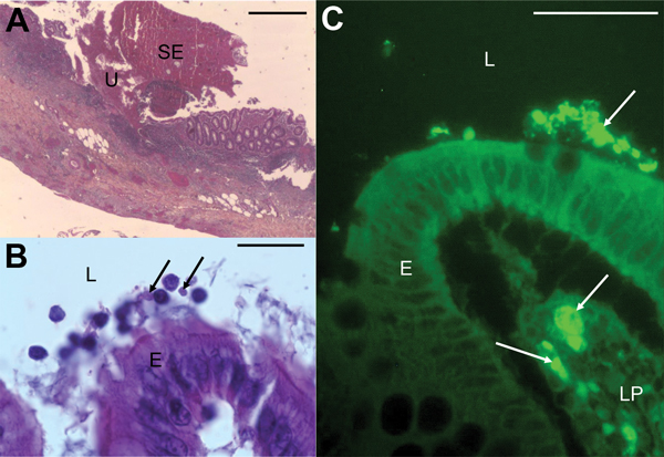 Micrographs showing histopathologic examination of appendix samples from a child who had peritonitis, Casablanca, Morocco, 2013. A) Ulceration (U) covered with suppurative and fibrinous exudates (SE) (hematoxylin-eosin stain). Scale bar indicates 200μm. B) Blastocystis parasites (arrows) in the lumen (L), and at the surface of the epithelium (E) (hematoxylin-eosin stain). Scale bar indicates 20μm. C) Blastocystis parasites (arrows) in the lumen, at the surface of the epithelium and in the lamina