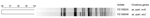 Thumbnail of UPGMA dendrogram of XbaI restriction patterns of 2 Shigella sonnei isolates from a patient from Finland who became ill during a visit to Morocco. Genomic comparison of the 2 isolates was performed by using pulsed-field gel electrophoresis according to the standard protocol. The isolates showed 96% similarity, and a 3-fragment difference suggests that 1 isolate was a variant of the other. Scale bar represents % similarity. ial, invasion-associated locus; ipaH, invasion plasmid antige