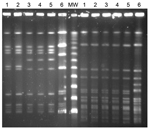 Thumbnail of Pulsed-field gel electrophoresis patterns of 6 Listeria monocytogenes serotype 1/2b isolates collected from listeriosis patients in Gipuzkoa, northern Spain, during January 2013–February 2014. Left side, after AscI restriction; right side, after SmaI restriction. Lanes 1 and 2, isolates from first outbreak (pattern A); lanes 3, 4 and 5, isolates from second outbreak (pattern B), including (lane 5) 1 isolate from a food product of foie gras; lane 6, L. monocytogenes sequence type 3 s