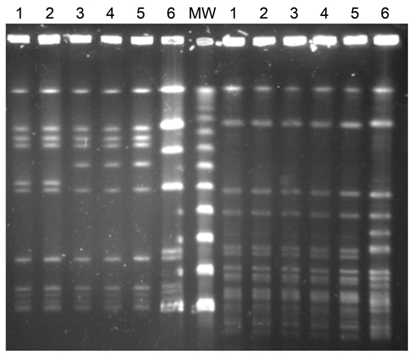 Pulsed-field gel electrophoresis patterns of 6 Listeria monocytogenes serotype 1/2b isolates collected from listeriosis patients in Gipuzkoa, northern Spain, during January 2013–February 2014. Left side, after AscI restriction; right side, after SmaI restriction. Lanes 1 and 2, isolates from first outbreak (pattern A); lanes 3, 4 and 5, isolates from second outbreak (pattern B), including (lane 5) 1 isolate from a food product of foie gras; lane 6, L. monocytogenes sequence type 3 serotype 1/2b 