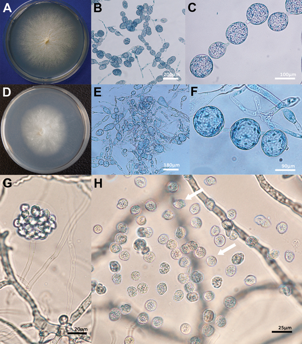 Morphologic features of isolates of Lagenidium giganteum mosquito control agent and L. giganteum mold from mammals. A) Phenotypic features in culture of the mammalian pathogen (ATCCMYA-4933, type strain) and (D) the biological control (ATCC 36492). The development of spherical and ovoid 40- to 170-μm swelling segments (B, C, E, F) was the main feature of both mammalian and biocontrol strains. (G) A tubular body developed from an unseen segmented sporangium form a vesicle enclosing numerous zoosp