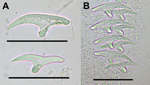 Thumbnail of Large and small rostellar hooks from protoscolices of Echinococcus vogeli. A) Large (top) and small (bottom) hooks. B) Rows of rostellar hooks. Scale bars indicate 40 μm.
