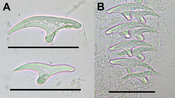 Large and small rostellar hooks from protoscolices of Echinococcus vogeli. A) Large (top) and small (bottom) hooks. B) Rows of rostellar hooks. Scale bars indicate 40 μm.