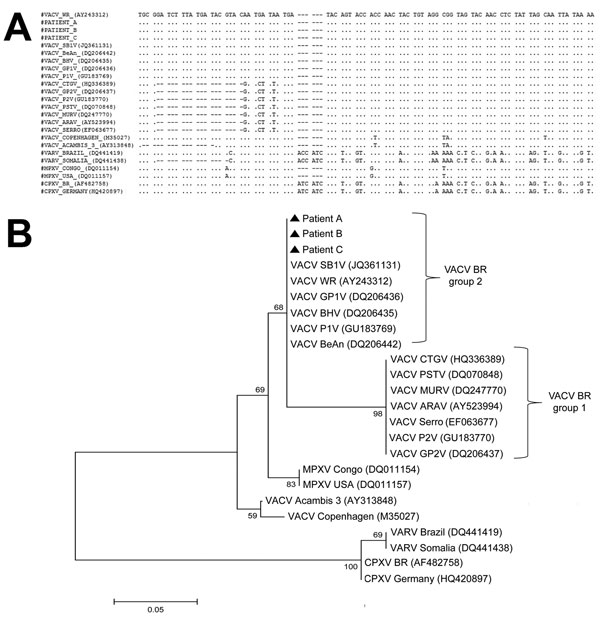 A) Nucleotide sequence of vaccinia virus (VACV) hemagglutinin gene and homologous sequences of several orthopoxviruses, Brazil. Dots indicate sequence identity; dashes indicate deletions. VARV, variola virus; MPXV, monkeypox virus; CPXV, cowpox virus. B) Consensus phylogenetic tree based on nucleotide sequences of orthopoxvirus hemagglutinin genes. Tree was constructed with hemagglutinin gene sequences by using the neighbor-joining method with 1,000 bootstrap replicates and the Tamura 3-paramete