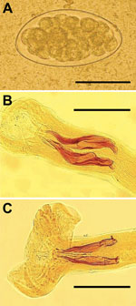 Thumbnail of Trichostrongylus spp. eggs and nematodes isolated from 1 patient in Guilan Province, Iran, 2014. A) Egg of diameter 87.5 × 48.0 μm obtained from fecal sample of patient by using formalin-ether method. Scale bar indicates 50 μm. B) Bursa copulatrix and spicules (slightly unequal, 135–156 µm long, and boat-shaped with a stepped tip and an outgrowth capping at proximal end) of T. colubriformis adult male. Scale bar indicates 100 μm. C) Bursa copulatrix and spicules (equal in size, 160–