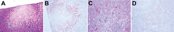 Histopathologic and immunohistochemical (IHC) testing results for Baikal teal. A) Focal necrosis in pancreas (hematoxylin and eosin [H&amp;E] stain). B) Avian influenza virus antigen in necrotic pancreatic acini ([IHC stain). C) Gout and renal tubular necrosis (H&amp;E stain). D) Avian influenza virus antigen in renal tubule cells (IHC stain). Original magnifications ×100.