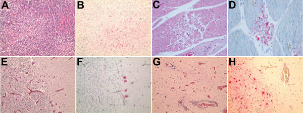 Histopathologic and immunohistochemical (IHC) testing results for bean goose. A) Diffuse necrotizing pancreatitis (hematoxylin and eosin [H&amp;E] stain). B) Avian influenza virus antigen in necrotic pancreatic cells (IHC stain). C) Segmental necrosis of myofibers with mildly swollen nuclei focal necrosis (H&amp;E stain). D) Avian influenza virus antigen in necrotic myofiber of the heart (IHC stain). E) Paucity of Purkinje cells, cerebellum (H&amp;E stain). F) Avian influenza virus antigen in Pu