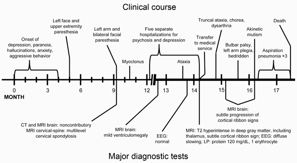 Timeline of course of illness and major diagnostic tests for US patient with variant Creutzfeldt-Jakob disease. CT, computed tomography; EEG, electroencephalography; MRI, magnetic resonance imaging.