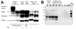 Thumbnail of Results of biochemical testing of a US patient with variant Creutzfeldt-Jakob disease (vCJD). A) Immunoblot of vCJD patient and controls. All the PK-treated preparations show similar electrophoretic profiles characterized by 3 bands displaying different mobilities according to number of the linked sugar moieties. The samples from this case and another vCJD case used as positive control (third lane) show the overrepresentation of the diglycosylated band, whereas in sCJD cases, the mo