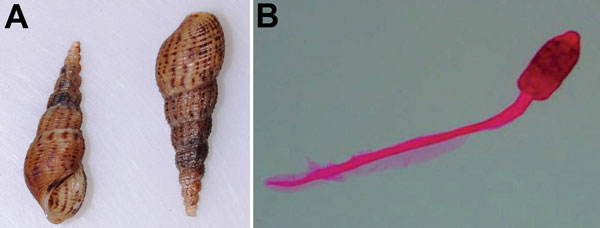 Snail and trematode cercaria from study of ocular inflammation in children, South India. A) Melanoides tuberculata snails collected from a pond that was the focus of the infection. B) Staining and light microscopy image of the cercaria larval stage recovered from the snails (original magnification × 200).