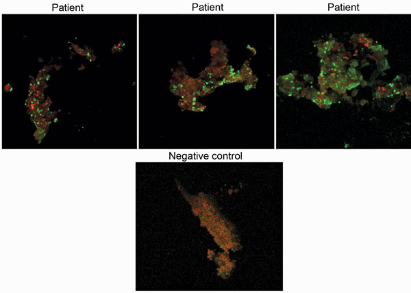 Immunofluorescence assay results of samples from 3 Candidatus Coxiella massiliensis–infected patients and 1 noninfected person (negative control).