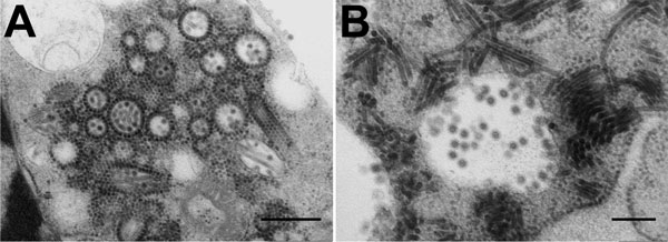 Electron micrographs of Middelburg virus isolate SAE25/2011 in baby hamster kidney cell culture. A) Several enveloped virions consisting of a dense core and surrounded by a translucent layer are shown in the vesiculated endoplasmic reticulum. The virus has elongated forms and numerous precursor nucleocapsids in the cytoplasm. Many of the nucleocapsids are associated with the outer surfaces of the vesiculated endoplasmic reticulum. Scale bar indicates 500 nm. B) Virions in a cytopathic vacuole ar