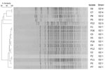 Thumbnail of Pulsed-field gel electrophoresis profiles of XbaI-digested genomic DNA from patient (P) and environmental (E) Elizabethkingia meningoseptica isolates from an outbreak in an adult critical care unit, London, UK, 2012–2013. Two additional isolates from patients demonstrated unique pulsed-field gel electrophoresis profiles and are not shown. Patient numbers (e.g., P9) match those given in Table 1.