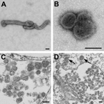 Thumbnail of Electron microscopic images of novel Thogotovirus isolate. Filamentous (A) and spherical (B) virus particles with distinct surface projection are visible in culture supernatant that was fixed in 2.5% paraformaldehyde. Thin-section specimens (C and D), fixed in 2.5% glutaraldehyde, show numerous extracellular virions with slices through strands of viral nucleocapsids. Arrows indicate virus particles that have been endocytosed. Scale bars indicate 100 nm.