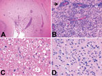 Thumbnail of Histopathologic features of brain tissue from foxes with possible virus-induced neurologic disease. A) Multifocal, randomly distributed areas of severe encephalitis and meningitis in the cerebrum (original magnification ×40). B) Detail of encephalitis in the cerebrum (original magnification ×200). Gray and, to a lesser extent, white matter of the cerebrum showed randomly dispersed areas of astrocytosis, gliosis, and infiltration with lymphocytes and plasma cells. Blood vessels in af