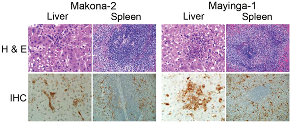 Pathologic results for 6 cynomolgus macaques infected with Ebola virus strains Makona or Mayinga. Liver and spleen sections were stained with hematoxylin and eosin (H &amp; E; top panels) and analyzed for necrosis, microthrombi, lymphocytosis, and inflammation. Sections were also stained with a polyclonal rabbit serum against Ebola virus viral protein 40 for detection of viral antigen (immunohistochemical [IHC] analysis; bottom panels). Sections from a representative animal in each group are sho