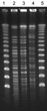 Thumbnail of Pulsed-field gel electrophoresis patterns of Nocardia cerradoensis isolates (after XbaI restriction enzyme digestion) from 3 chronic obstructive pulmonary disease patients in Gipuzkoa, northern Spain. Lanes 1 and 5, DNA molecular weight marker (50-kbp ladder). Lanes 2, 3, and 4, isolates corresponding to patients 1, 2, and 3, respectively.
