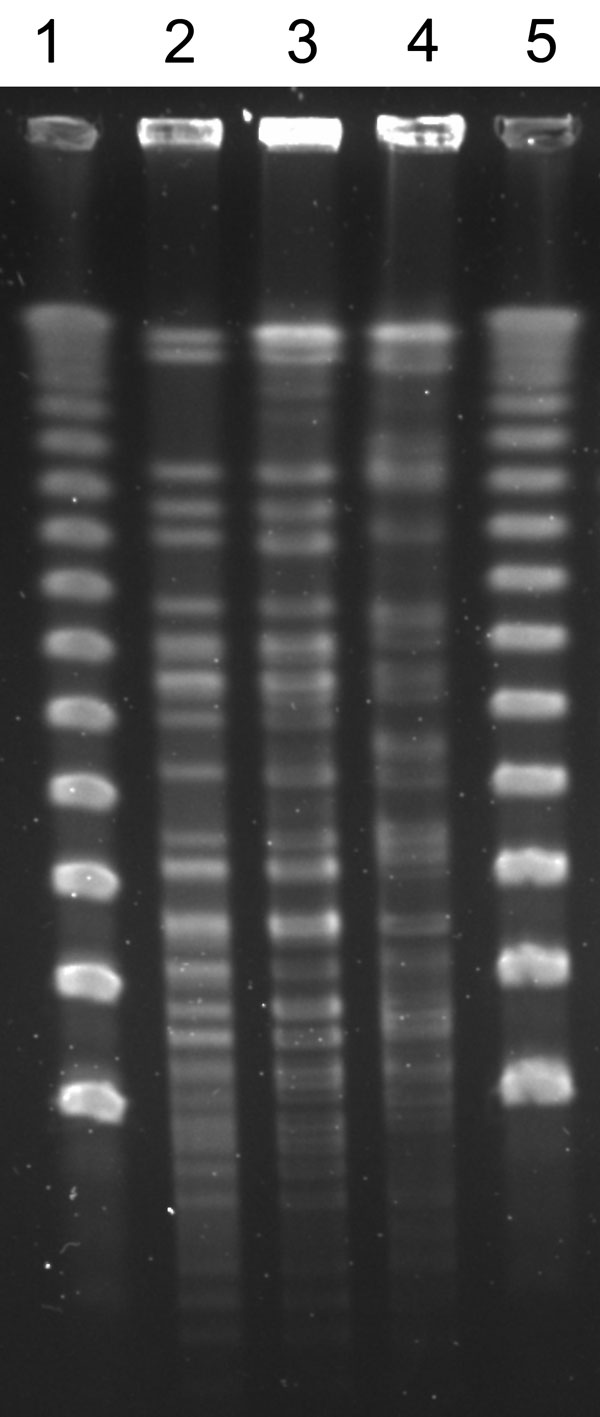 Pulsed-field gel electrophoresis patterns of Nocardia cerradoensis isolates (after XbaI restriction enzyme digestion) from 3 chronic obstructive pulmonary disease patients in Gipuzkoa, northern Spain. Lanes 1 and 5, DNA molecular weight marker (50-kbp ladder). Lanes 2, 3, and 4, isolates corresponding to patients 1, 2, and 3, respectively.