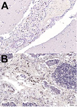 Thumbnail of Mayer hematoxylin counterstained tissue samples from a newborn fin whale stranded off the Mediterranean Sea, October 2013. A) Brain tissue showing positive immunostaining for morbillivirus. antigen in macrophages in the meningeal space. B) Fin whale thymus showing positive immunostaining for morbillivirus antigen in thymocytes and macrophages. For both samples, morbillivirus was detected by immunohistochemical analysis, using a rabbit hyperimmune anti–rinderpest virus serum (provide