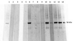 Thumbnail of Western blot analysis, using Orientia 56Kpr recombinant protein, of serum samples from febrile children in western Kenya, November 2011–December 2012. Lane 1, positive control; lane 2, negative control; lanes 3–4, Coxiella burnetii–positive patients; lane 5, Orientia spp.–negative patient; lanes 6–14, Orientia spp.–positive patients.