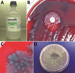 Thumbnail of Bacterial culture results for 1,000-mL bottle of wound irrigation fluid in laboratory investigation of a 2012–2013 cutaneous melioidosis cluster in the temperate southern region of Western Australia. A) Wound irrigation fluid in original bottle. B) Direct primary culture of wound irrigation fluid on blood agar plate, showing growth inhibition of Pseudomonas aeruginosa and revealing Burkholderia pseudomallei around gentamicin disk. C) Filtrate of wound irrigation fluid from same bott