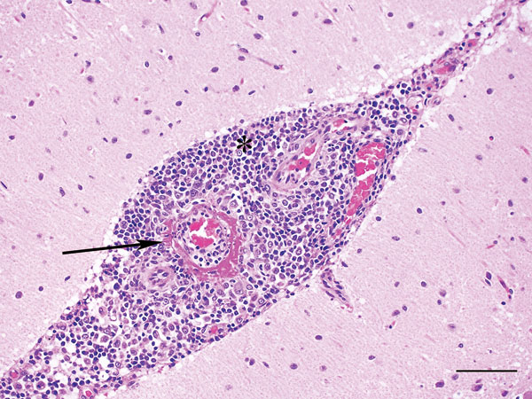 Cerebellum of dog infected with Hendra virus, showing expansion of the meninges with inflammatory infiltrates (*) and marked vasculitis (arrow). Scale bar indicates 75 μm.