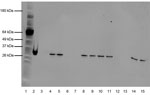 Thumbnail of Western blot of pertussis toxin (Pt) expression in Bordetella pertussis Tohama I, I979, FR3749, and 3 additional recent isolates. All isolate lanes were loaded with 10-μg of protein, extracted after 48 hours’ growth. Protein was transferred with the iBlot Dry Blotting system (Invitrogen, Carlsbad, CA, USA). The primary antibody consisted of 1b7 anti-PTX S1 monoclonal antibody at a concentration of 20 μg/mL diluted in 0.01 M PBS/Tween with 5% milk. The secondary antibody was a FITC-c