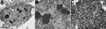 Thumbnail of Electron micrographs of polyomavirus-like particles in lung from a child with fatal acute respiratory illness. A) Low-power view of a nucleus displaying multiple electron dense crystalline arrays. Scale bar indicates 0.5 μm; original magnification ×10,000. B) Higher-power magnification of nucleus in panel A. Scale bar indicates 100 nm; original magnification ×30,000. C) Large cluster of putative polyomavirus virions. Scale bar indicates 250 nm; original magnification ×20,000.
