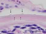 Thumbnail of Histologic section of the eye of a dog infected with Onchocerca lupi nematodes, Summerside, Prince Edward Island, Canada. The typical O. lupi nematode cuticular pattern is shown, with 2 inner transverse striae (dashed arrows) within the interval between 2 outer cuticular ridges (solid arrows). Hematoxylin and eosin stain, original magnification ×100. Scale bar indicates 20 μm. 
