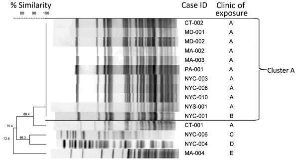 Dendrogram of rapidly growing mycobacteria in surgical site infections among patients in the US associated with medical tourism to the Dominican Republic, 2013–2014. Patients were exposed in 5 known clinics and 1 unknown clinic (data not shown). Pulsed-field gel electrophoresis band patterns for available Mycobacterium abscessus complex isolates were restricted with the Asel enzyme and run at 3 and 20 seconds for 20 hours. Isolates with indistinguishable band patterns are labelled cluster A. Cas