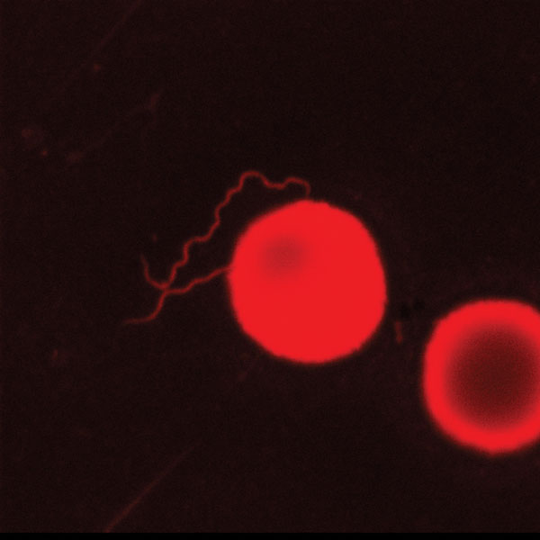 Borrelia miyamotoi in cerebrospinal fluid stained by acridine orange (LSM Exciter 5, Zeiss, Germany). The cerebrospinal fluid was from a 74-year-old woman with non-Hodgkin lymphoma. Original magnification ×1,000.