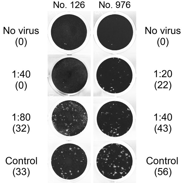 Middle East respiratory syndrome coronavirus (MERS-CoV) plaque-reduction neutralization test (PRNT) results for 2 serum samples positive by recombinant ELISA, showing virus neutralization activity against MERS-CoV strain EMC/2012 exceeding a titer of 1:10. Titers and number of plaques (in parenthesis) are shown next to the corresponding images. Sample no. 976 showed &gt;50% plaque reduction up to a titer of 1:20, and sample no. 126 showed &gt;90% plaque reduction up to a titer of 1:40. No serum 