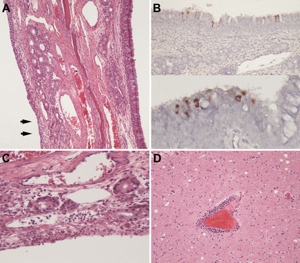 Signs of mild upper respiratory inflammation, encephalitis, and virus antigen detection in respiratory epithelium of alpacas experimentally infected with Middle East respiratory syndrome coronavirus. A) Turbinate from alpaca A8 showing normal respiratory epithelium on the right with goblet cells (blue cells). Epithelium on the left has undergone squamous metaplasia (arrows) and is focally eroded with mild subepithelial inflammation (original magnification ×100). B) Virus antigen in apparently in